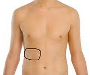 What is a cracked rib treatment?
