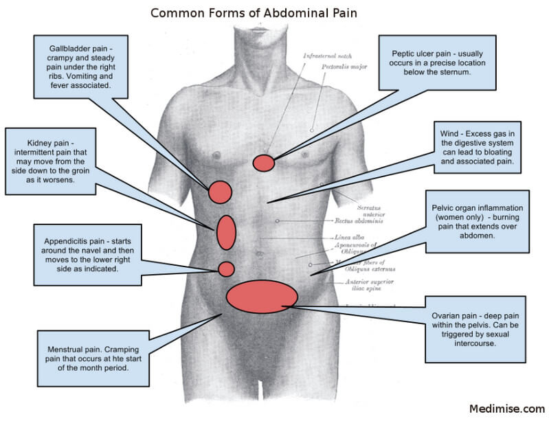 what-can-cause-upper-abdominal-pain