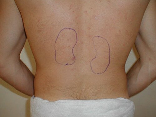 kidney right and left surface anatomy marking