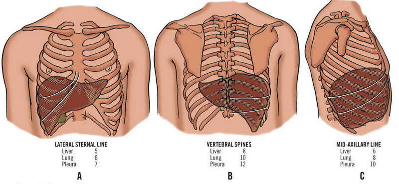 liver anatomy lines