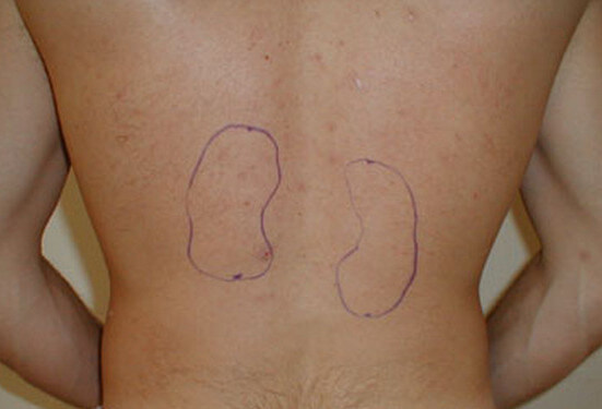 Kidney Pain Vs Right Left And Central Abdominal Pain La Vaca Cega