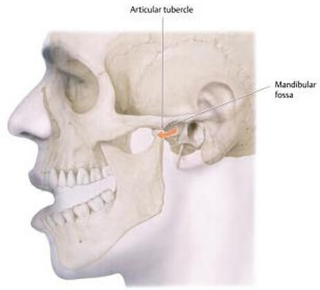 Dislocation of temporomandibular joint (TMJ) image