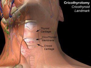 Cricoid Cartilage Definition Location Function Problems Updated