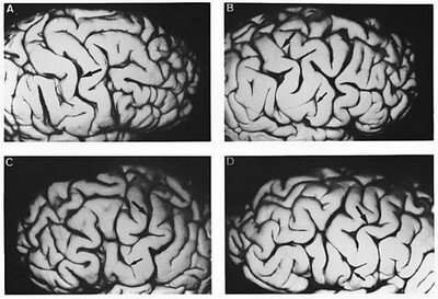 Patterns of the Central Sulcus photo