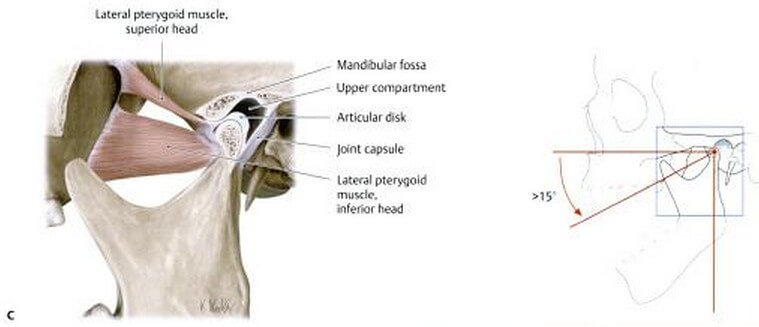 mandible lateral pterygoid muscle picture