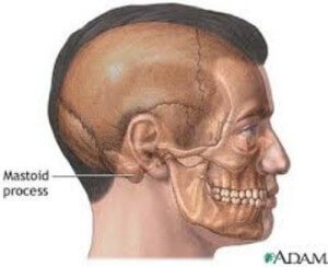 mastoid mastoiditis mastoideus processus mastoide cells processo mastoidectomy