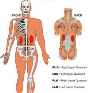 Kidney Pain and Location - Stones and Vs Back pain