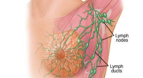 auxiliary lymph nodes and ducts which may become inflamed