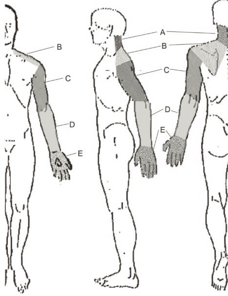 region of pain neck shoulder scapula arm forearm hand fingers