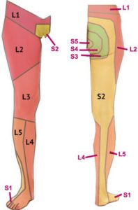 Facet Arthropathy - Definition, (lumbar, cervical, mild, moderate ...