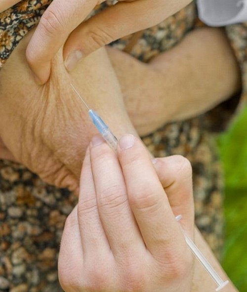 An intravenous injection introduced to the arm of an elderly patient.photo