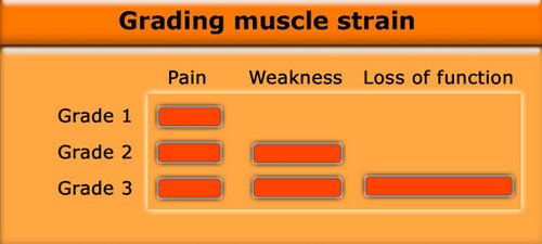 Muscle strain grading and their corresponding symptoms.image