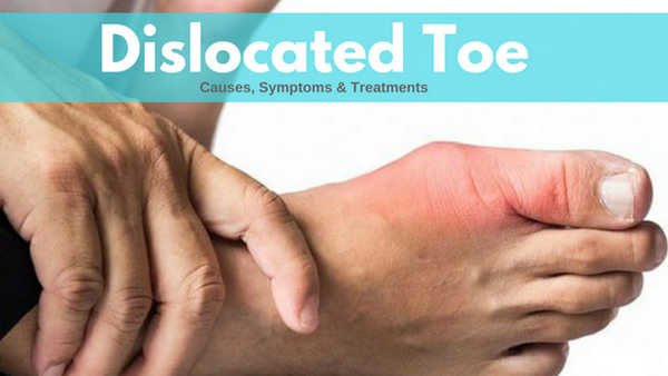 A dislocated toe characterized by redness, swelling, and a bone out of place image photo picture