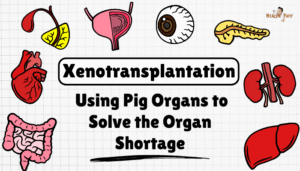 Xenotransplantation- Using Pig Organs to Solve the Organ Shortage